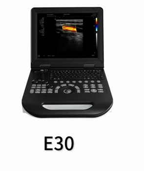 Prenosné farba ultrazvuk E30 s brušnej vypuklé pole sondy Obrázok